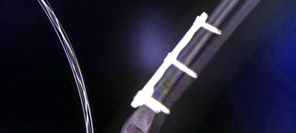 orthopedics